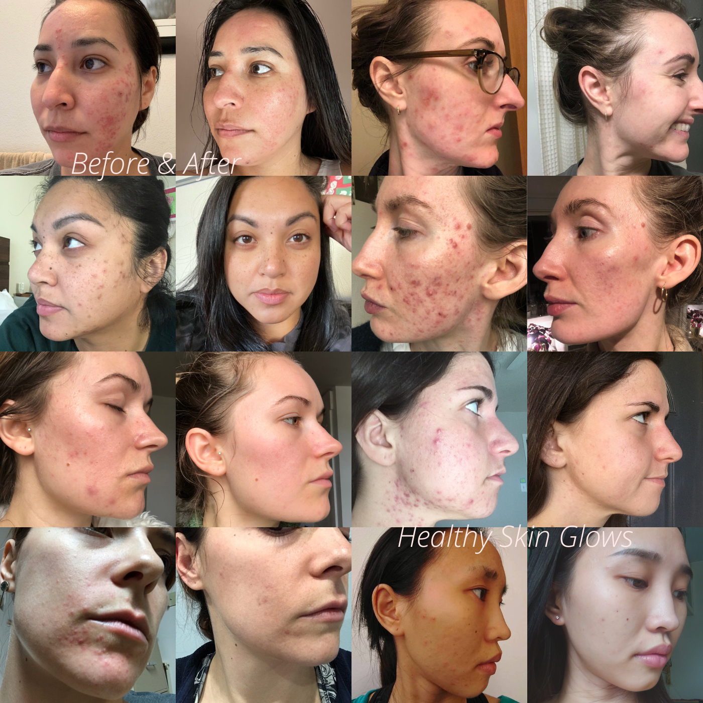 Before & After Healthy Skin Glows